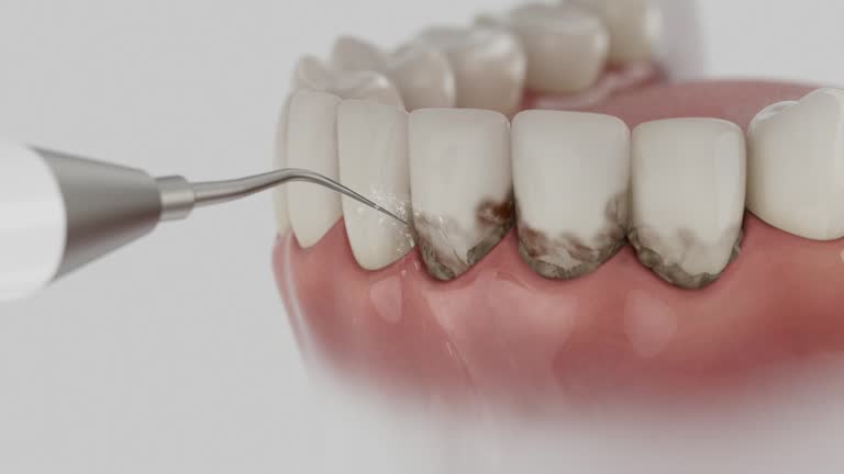 Trusted Teeth Cleaning And Checkup service in Quakertown, PA - Dentist Open Now